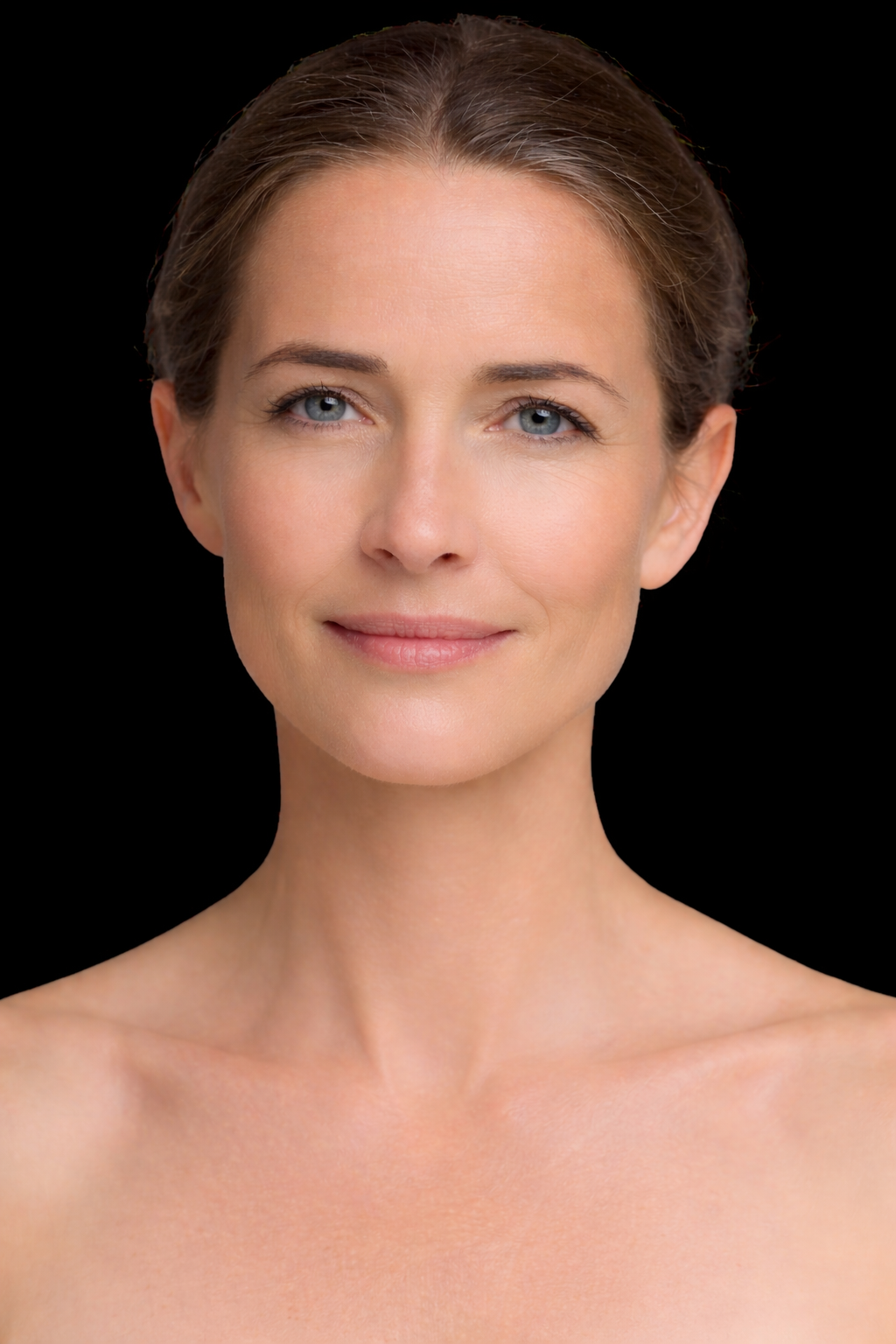 Paciente después del tratamiento estético con resultados naturales