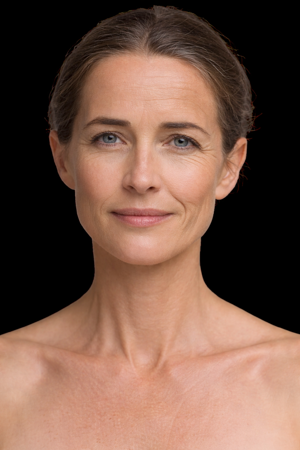 Paciente antes del tratamiento estético